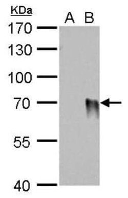 Influenza A H1N1 Hemagglutinin Antibody (GT223) - (A/WSN/1933), Novus Biologicals